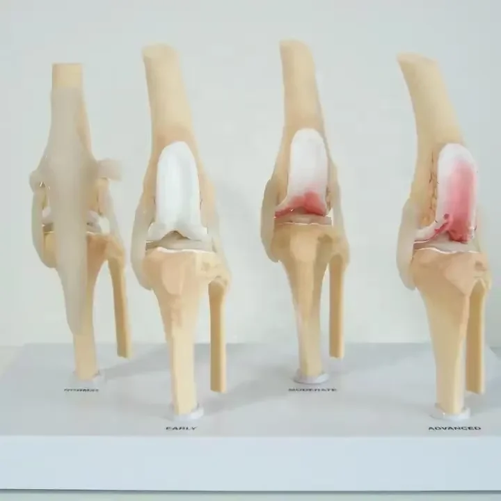Dog Four Stage Knee Arthritis Model Anatomical Model Knee Joint Animal Models