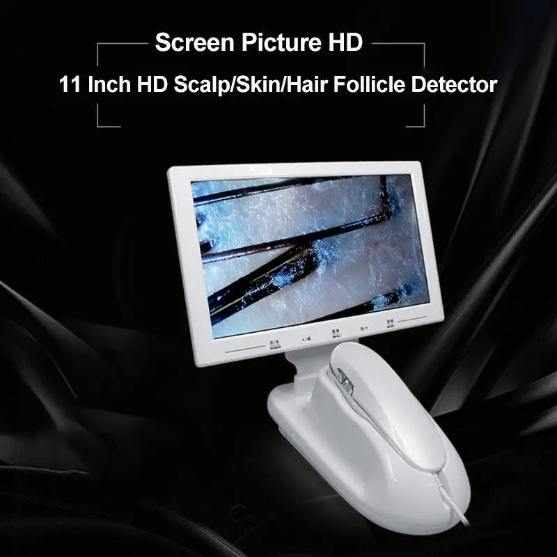 1080p high resolution 11 inch skin analyzer Hair follicle detector Hair analyzer head therapy special instrument