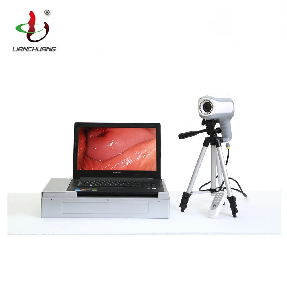 Cheapest handheld portable electronic video colposcope price
