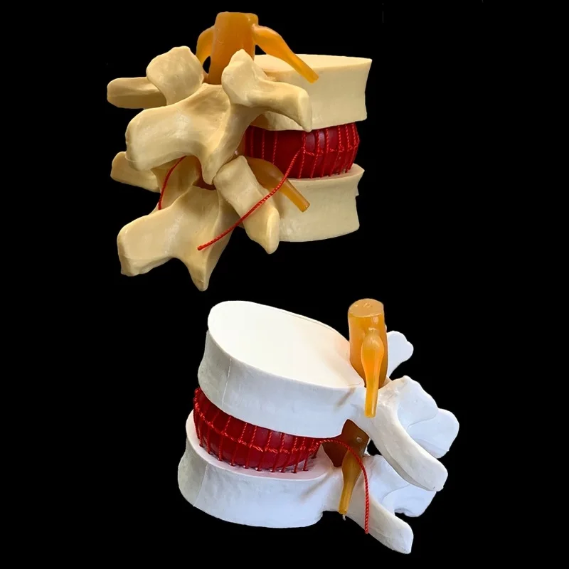 Spine Model Human spine model full size demonstration model of human lumbar intervertebral disc compression for medical teaching