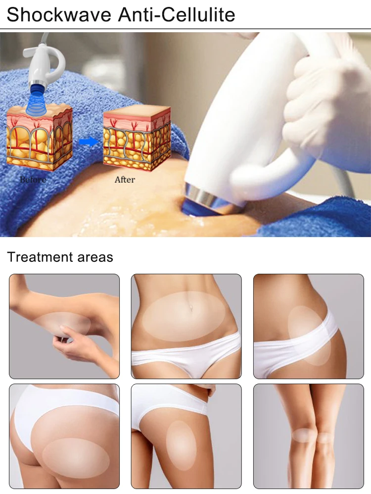 New Design Shockwave Non-invasion Anti-cellulite Muscle Relaxing Body Therapy Massage Equipment for Pain Relief Treatment