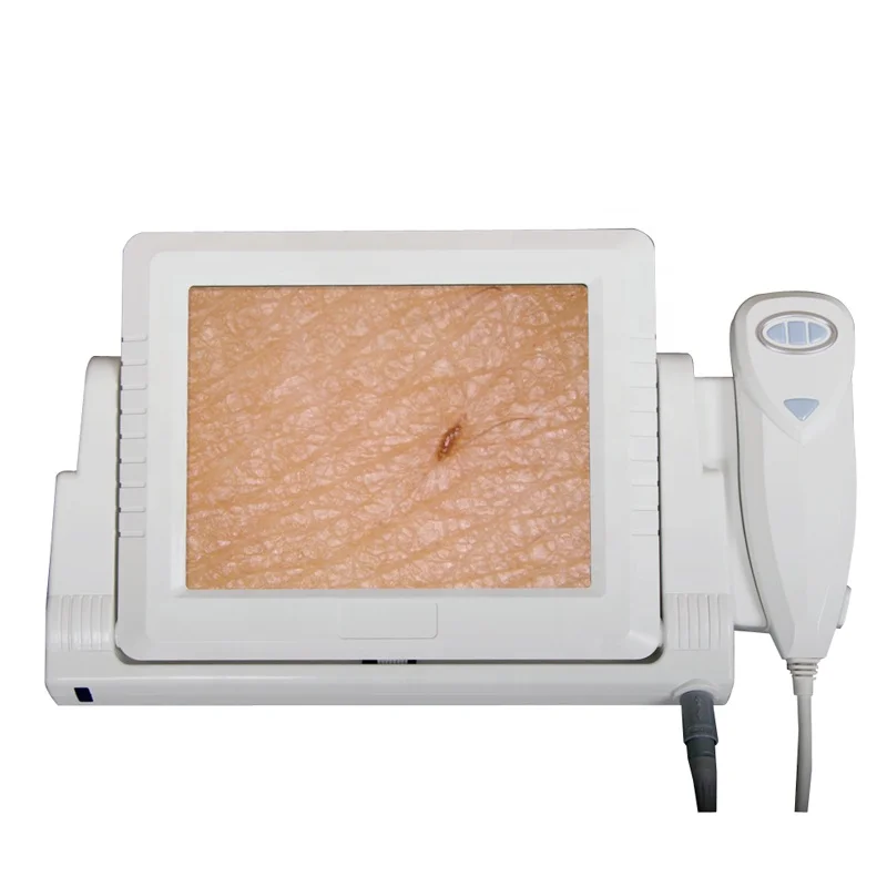 hairdressing chain stores 8 inch screen CCD high definition hair detector skin and hair analyzer Machine