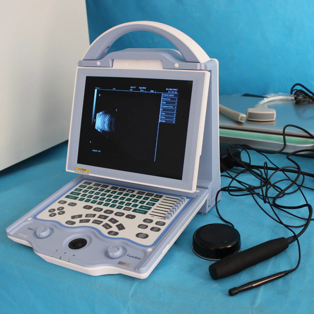 Full Digital Ultrasonic Diagnostic System Portable AB-scan Ophthalmic Ultrasound for Human and Vet
