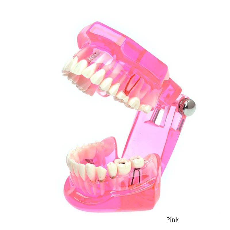 High quality lab typodont dental model practice dental implant model