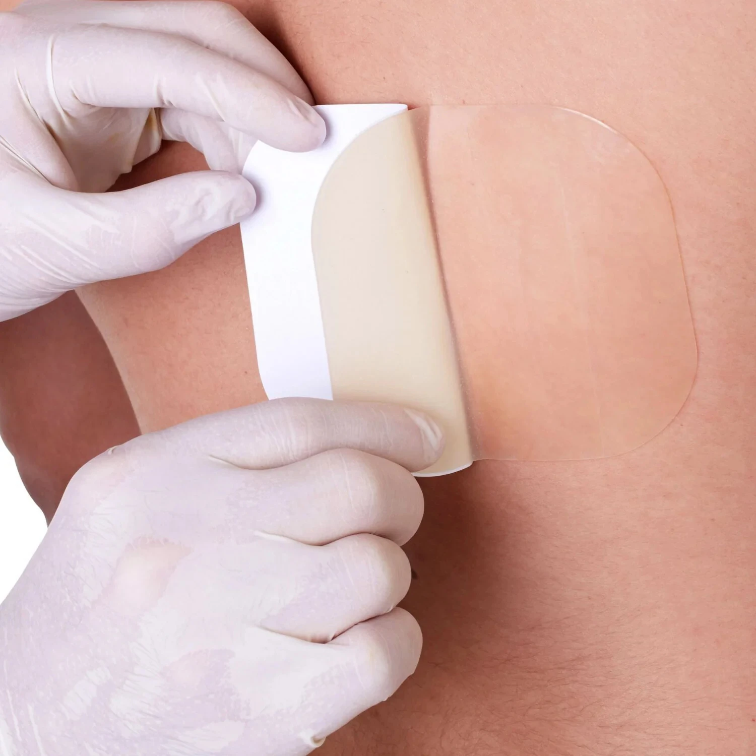 UNIMASTER Medical Hypoallergenic Wound Adhesive Dressing Protector Wound Care Dressing Product