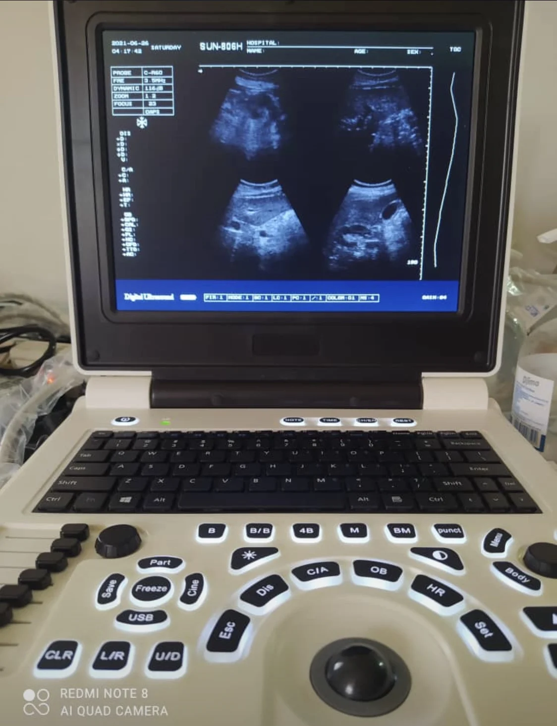 CE certified medical portable ultrasound machine with musculoskeletal newest linear ultrasound system