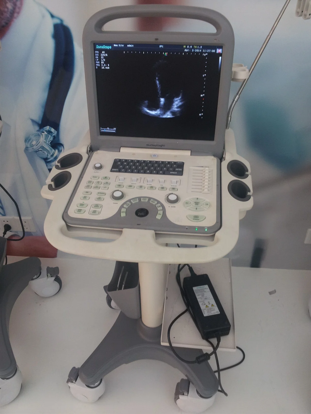 Sonoscape S6 Portable 4D Color Doppler Ultrasound For Human