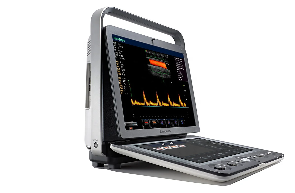 Sonoscape S9 medical ultrasonic equipment ultrasound machine portable ecografo doppler ultrasound
