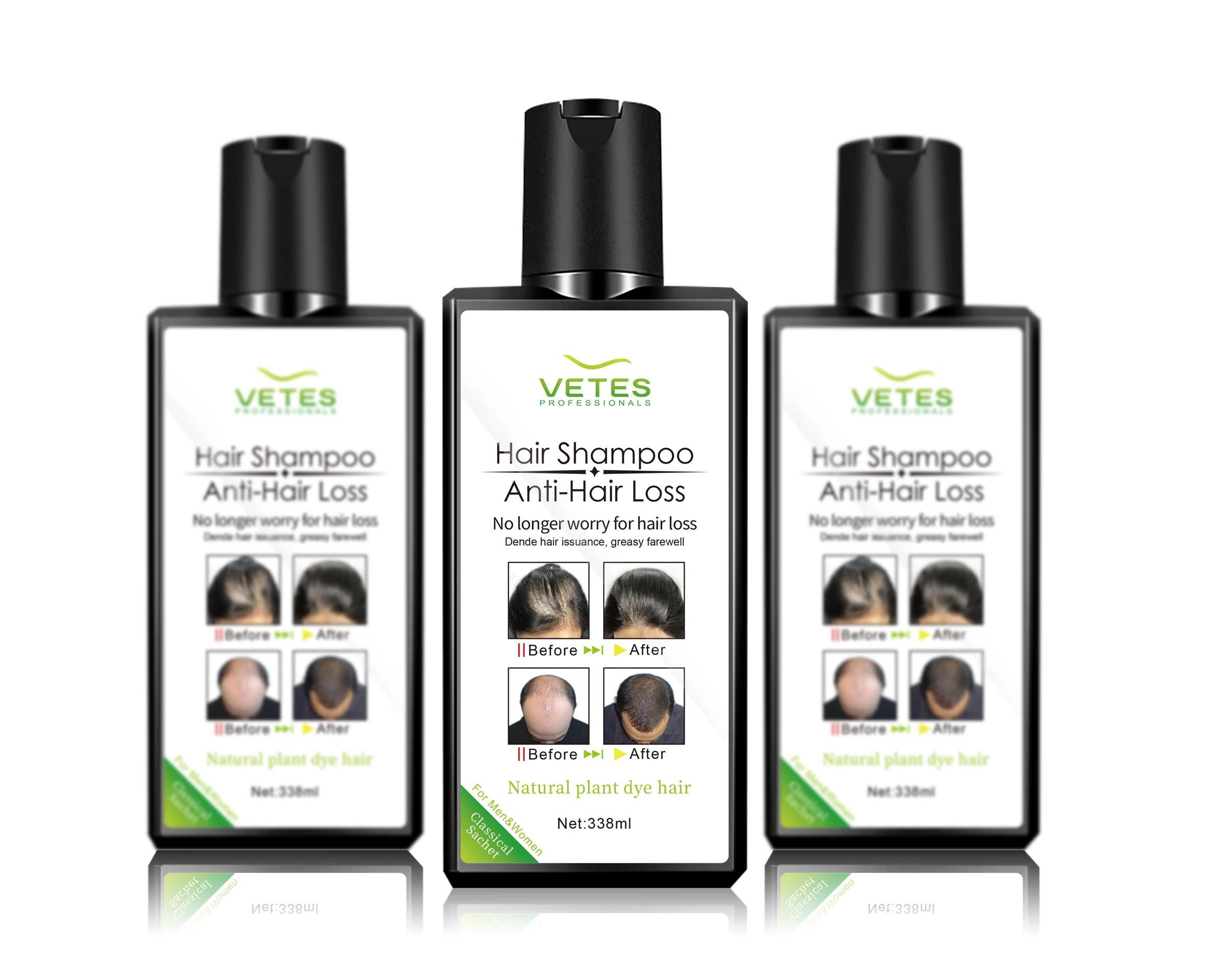 Natural organic shampoo for anti-hair loss Hair growth Anti hair fall shampoo