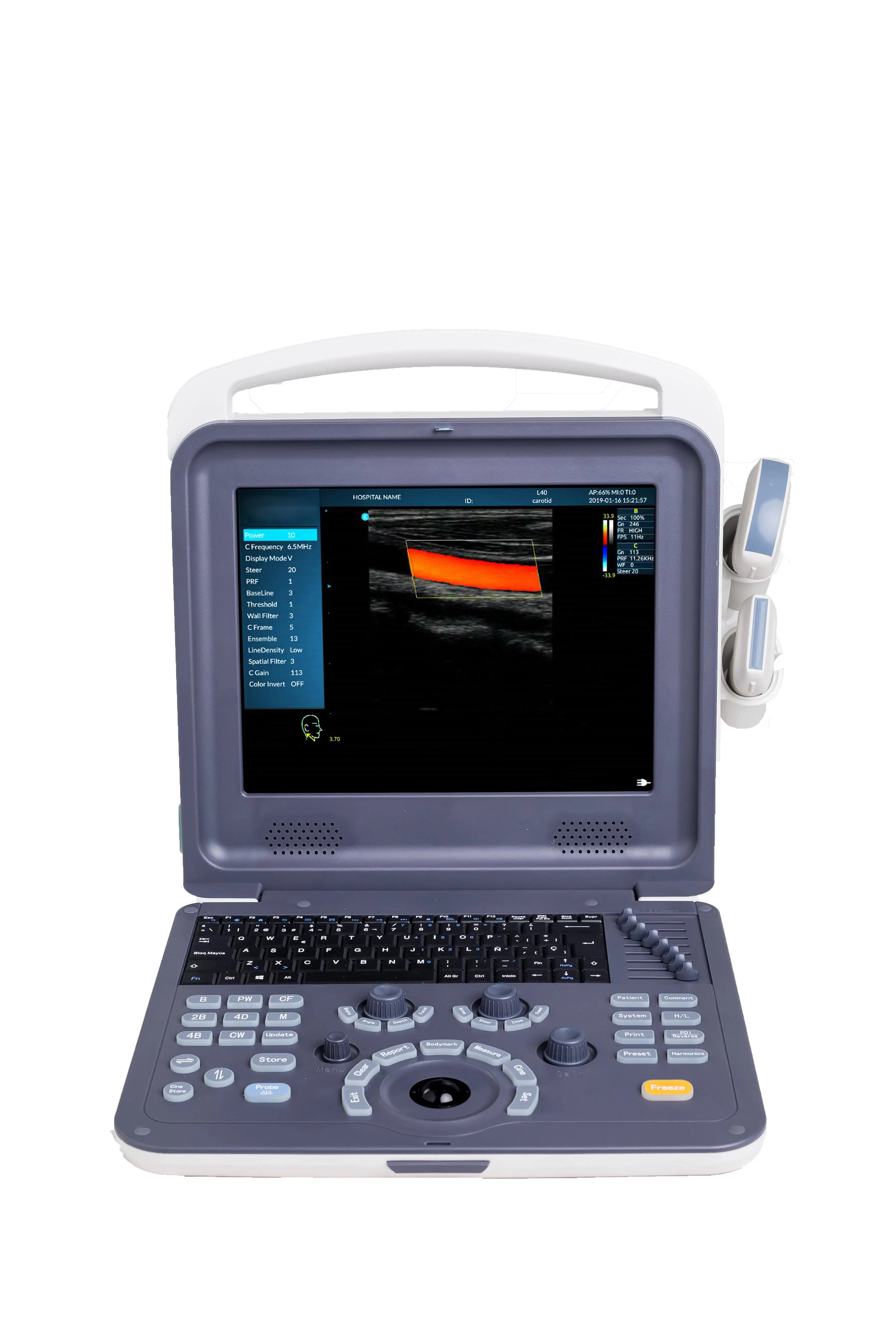 Amain Factory Wholesale Price Portable Ultrasound Color Doppler Ultrasound Scanner For Vet & Human