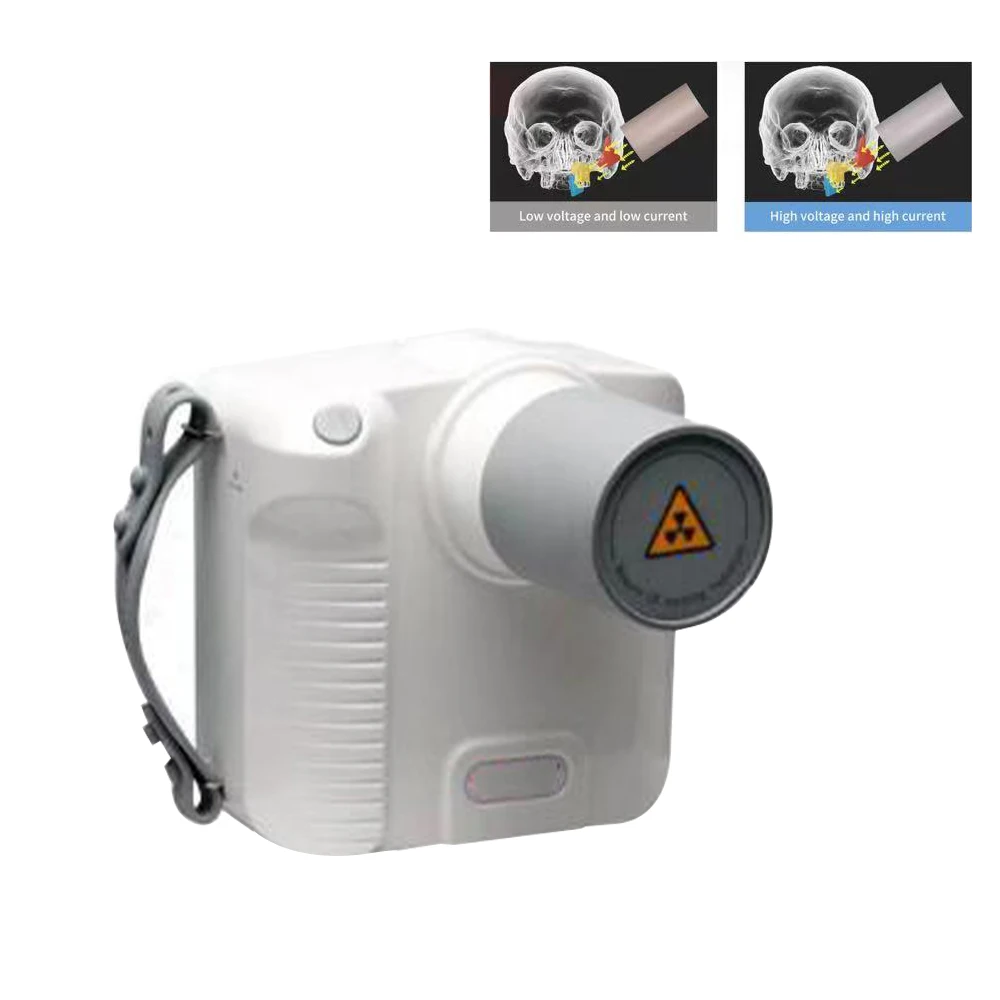 MY-D038K dental portable X ray machine / Dental digital xray imaging camera RX rayos handheld Xray unit equipment for clinic