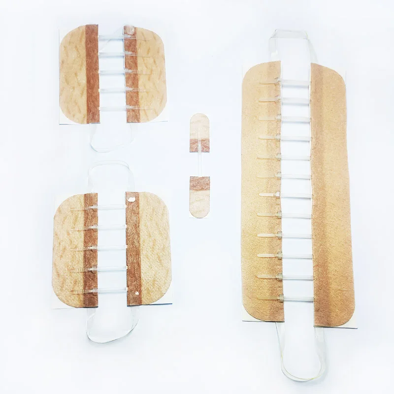 Chinese Factory Direct Wholesale High Pulling Force 1.5 CM Wound Closure Strips  Alternatives For Wound Sutures