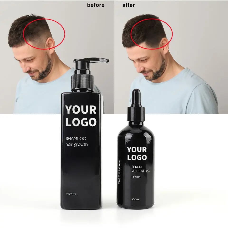 Hair Treatment Products Organic Best Natural Salon Hair Professional Ginger Shampoo for Hair Care