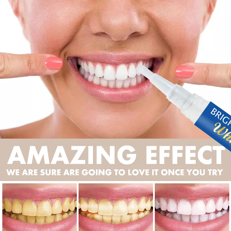Private Label Oral Care Korean Herbal OEM oral Health teeth whitening gel grillz for teeth Organic Green Tea Teeth Whitening Pen