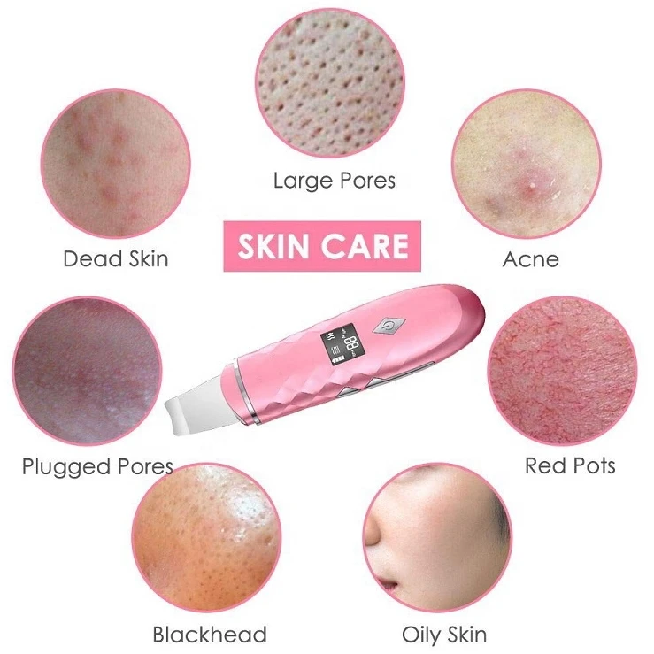 Biumart Skin Scrubber Portable Electric Face Skin Pore Cleaning Spatula Beauty Personal Care Machine For Vibration Exfoliating