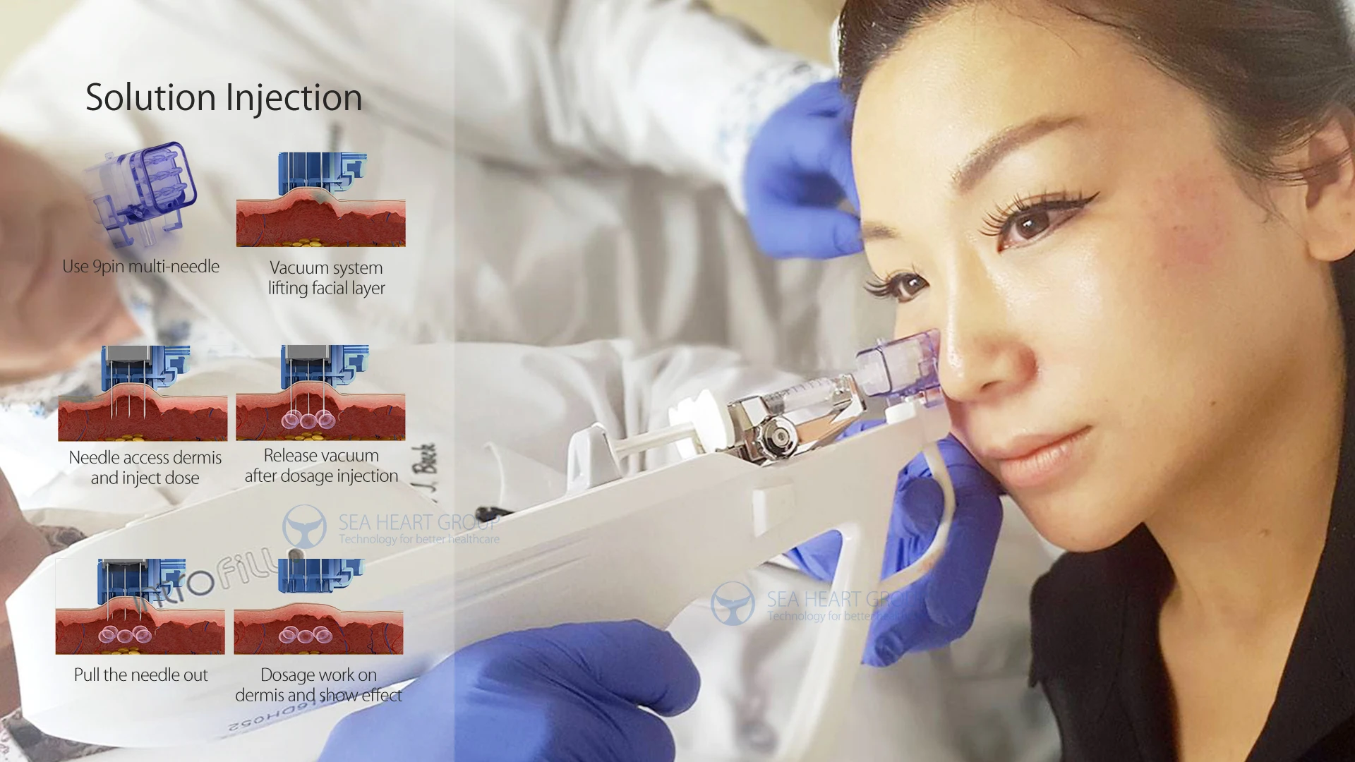 Auto Injection System INTROFILL Meso Injector Mesotherapy Gun with Medical CE