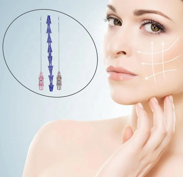 Высокое качество подтяжка лица ПДО для ухода за кожей лица подтяжки кожи литья нить