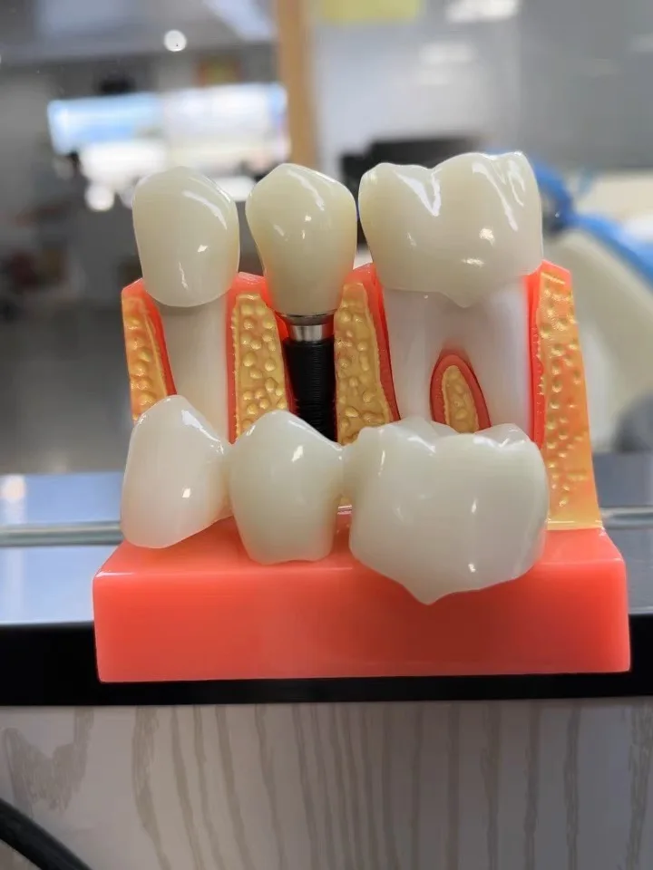 Высококачественная и детализированная полноцветная 3D-печать с изображением крабов животных профессиональная быстрая печать Sls SA 3d производители
