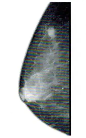 Mammography film/ medicalx ray film / MNedical consumbable