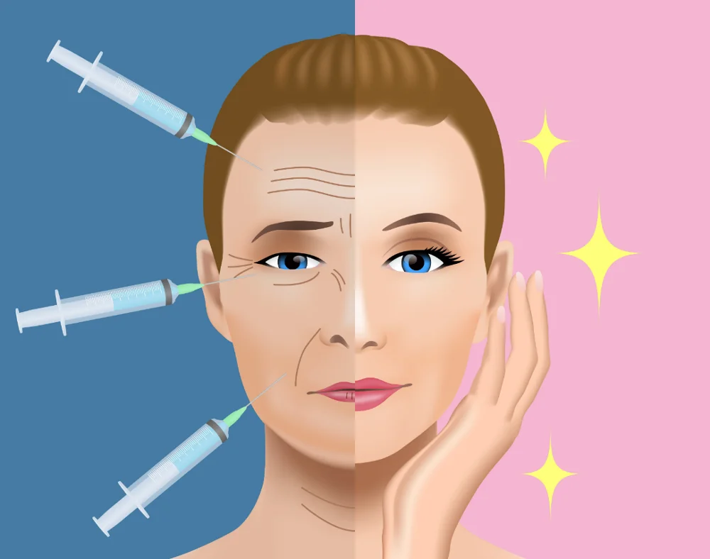  Корейская инъекционная Гиалуроновая кислота медицинская тупая игла cannula наполнитель размеры