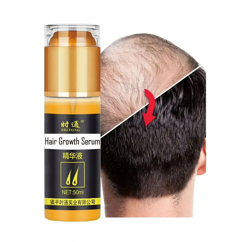 Buy stuff in bulk to resell hairgrowth rice water hair growth spray
