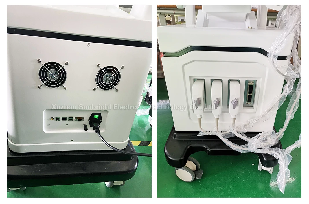 Full-digital Trolley color doppler 3D 4D medical scan machine ultrasound