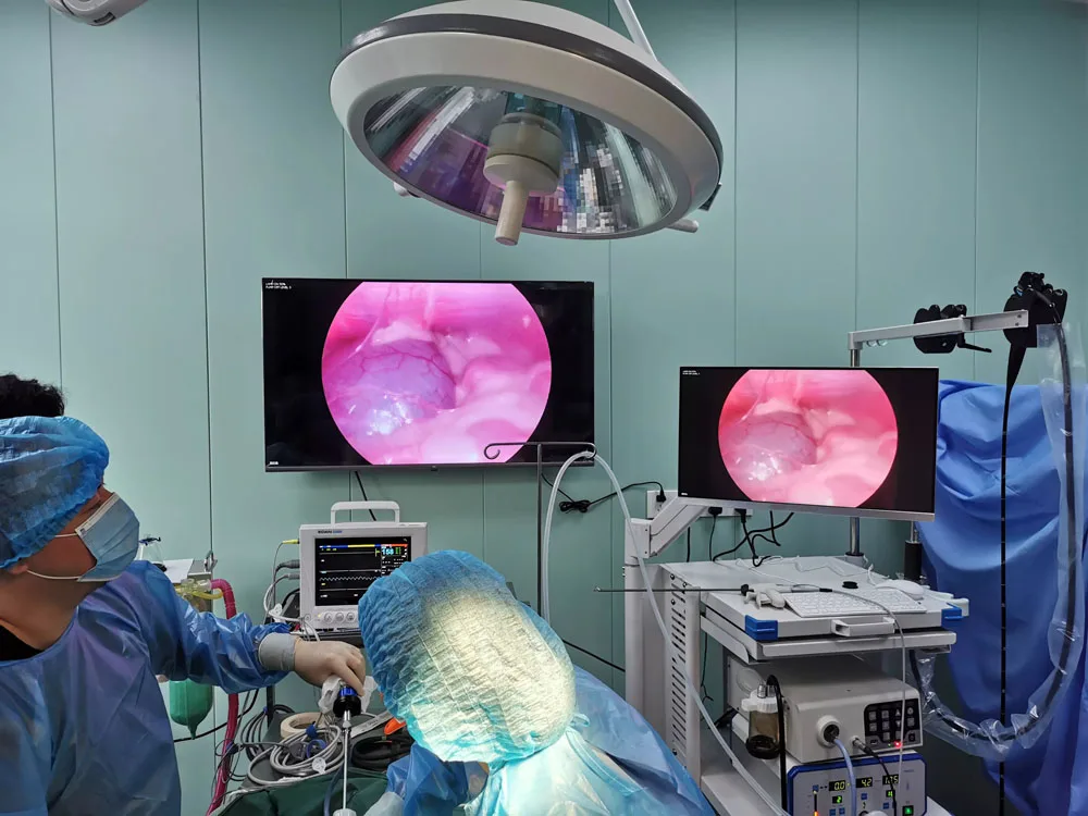 Portable Veterinary Medical Veterinary Bronchoscope for small animals