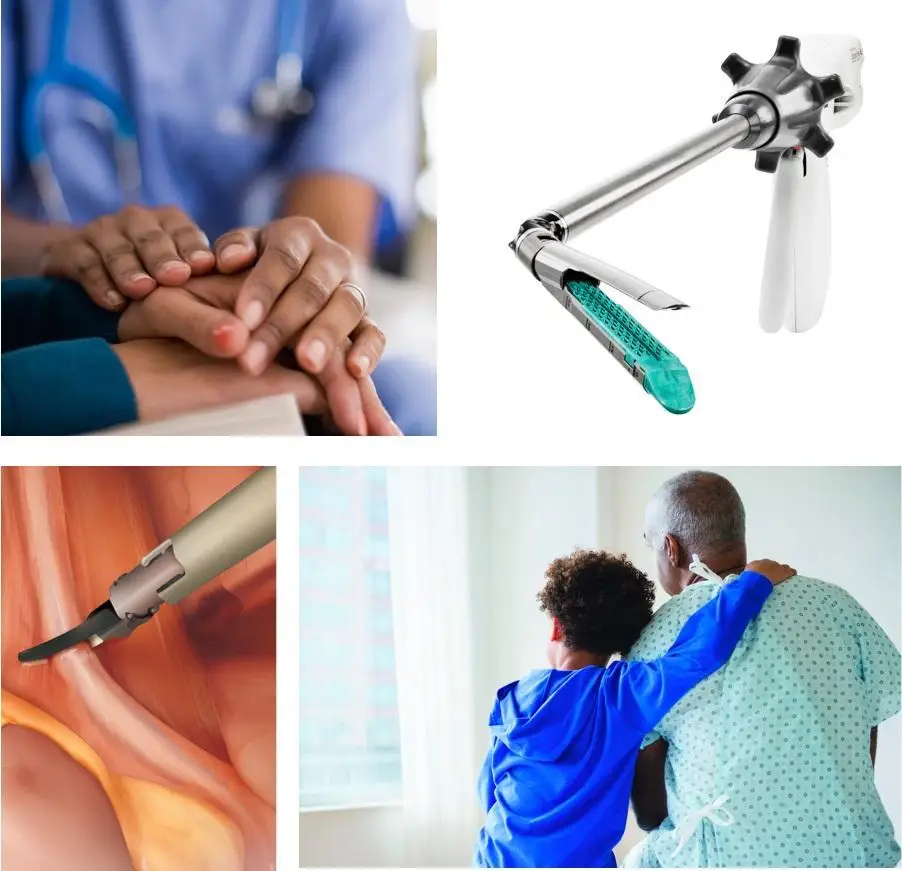 Surgical Instruments Disposable Endoscopic linear cutter stapler And Reloads For Abdominal Minimally Invasive