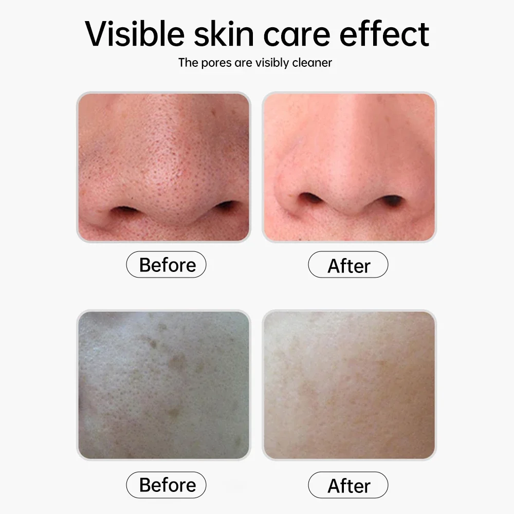 New Product Led Display Facial Ultrasonic Scrubber Acne Pore Face Sonic Beauty Care Skin Scrubber Spatula