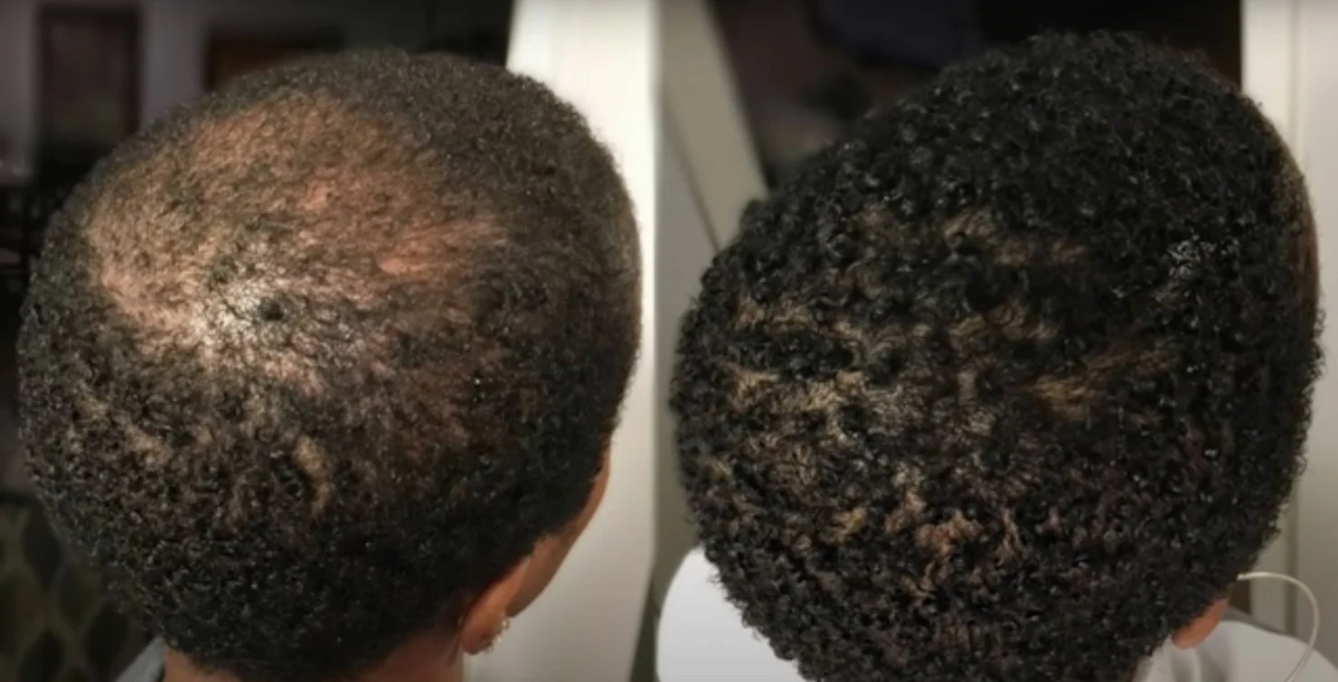 private label batana oil butter