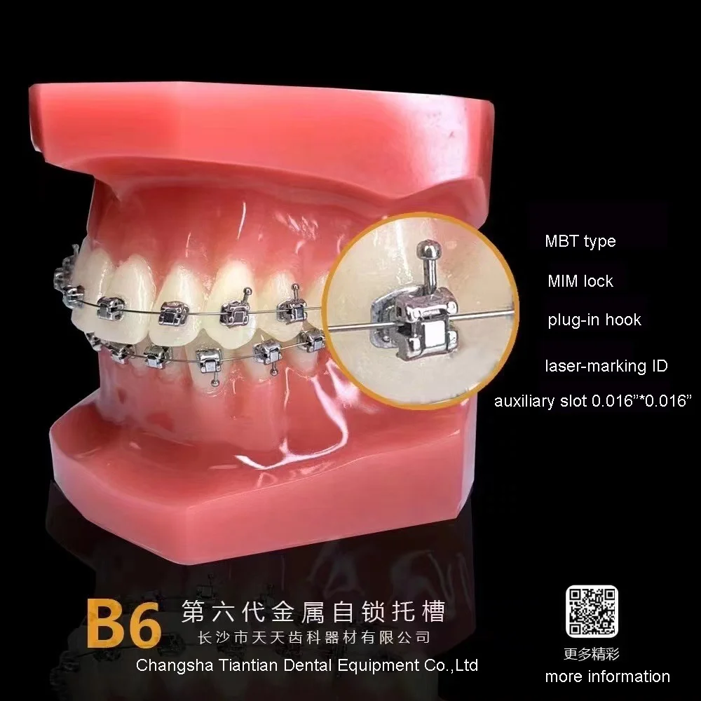 factory wholesale high quality dental product self locking orthodontic brackets self ligating mbt system