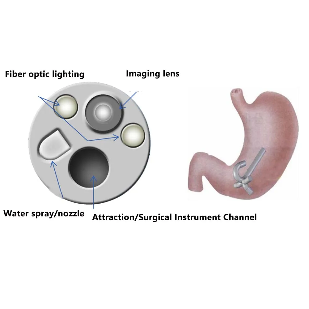 Newly listed gastroscopy colonoscopy medical gastrointestinal endoscopy system Animal endoscopic