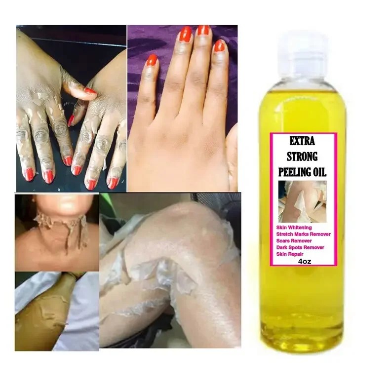 Private Label Extra Strong orange extra strong Peeling Oil Whitening Yellow Peeling Oil
