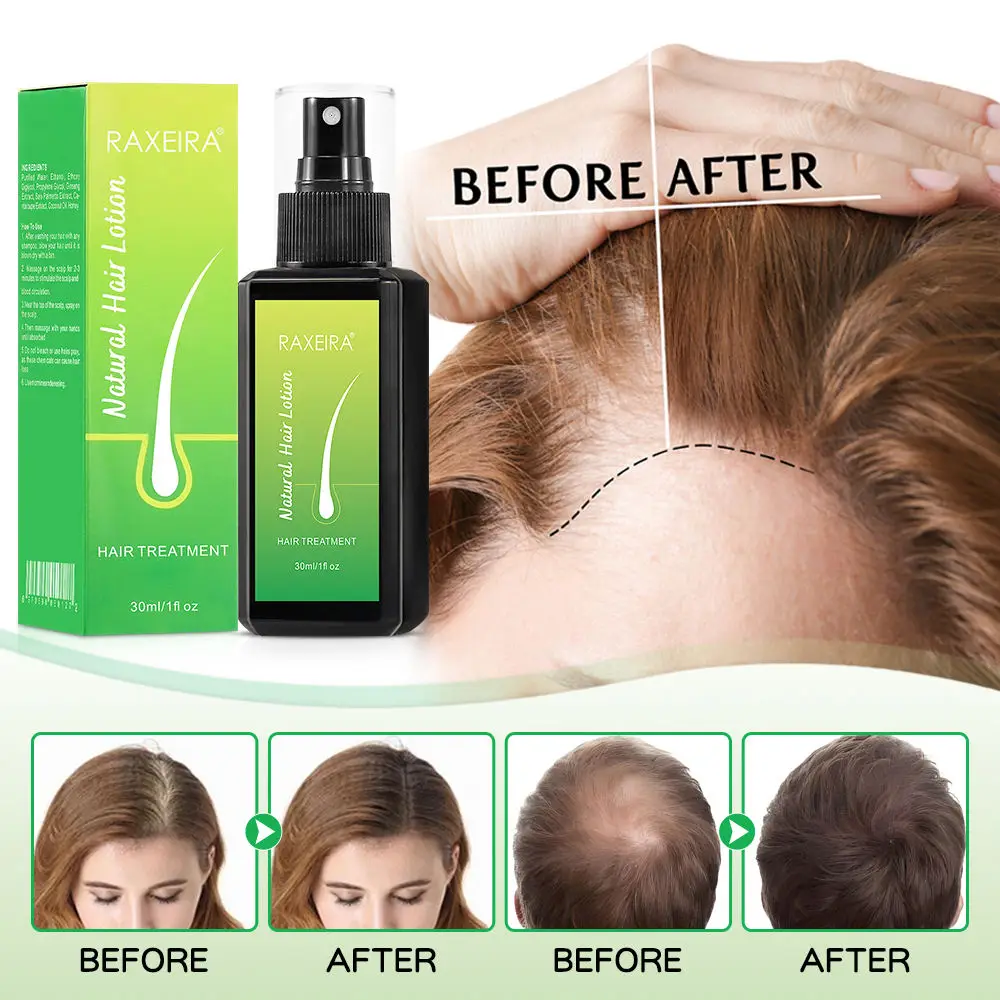 Private Label Organic Fast Thick Hair Growth Serum oil Lotion Spray Anti Baldness Hair Loss hair Growth Lotion