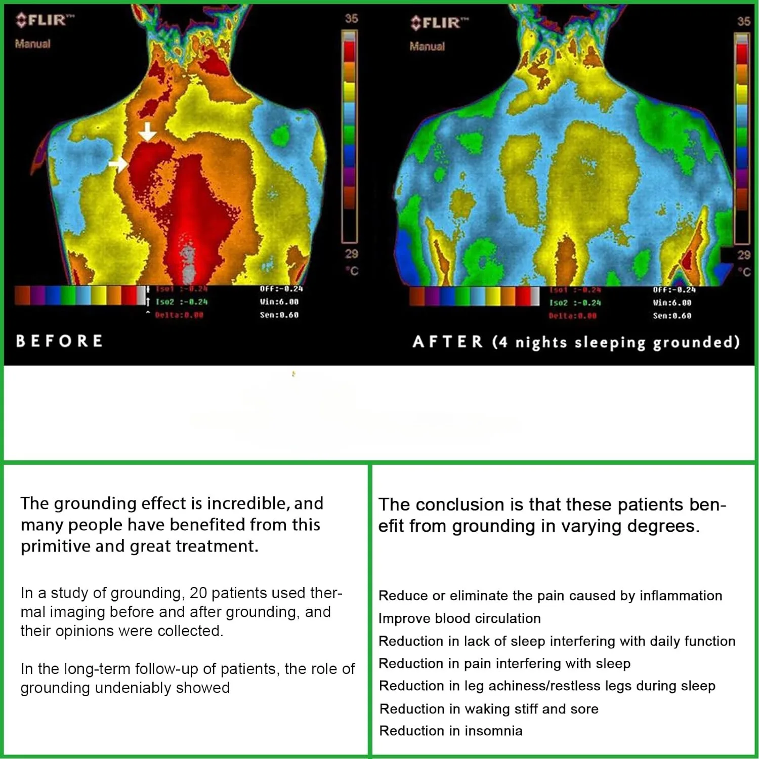 Grounding Sheets with Silver Fiber & Organic Cotton - Conductive with Grounding Cord, Grounding Keep