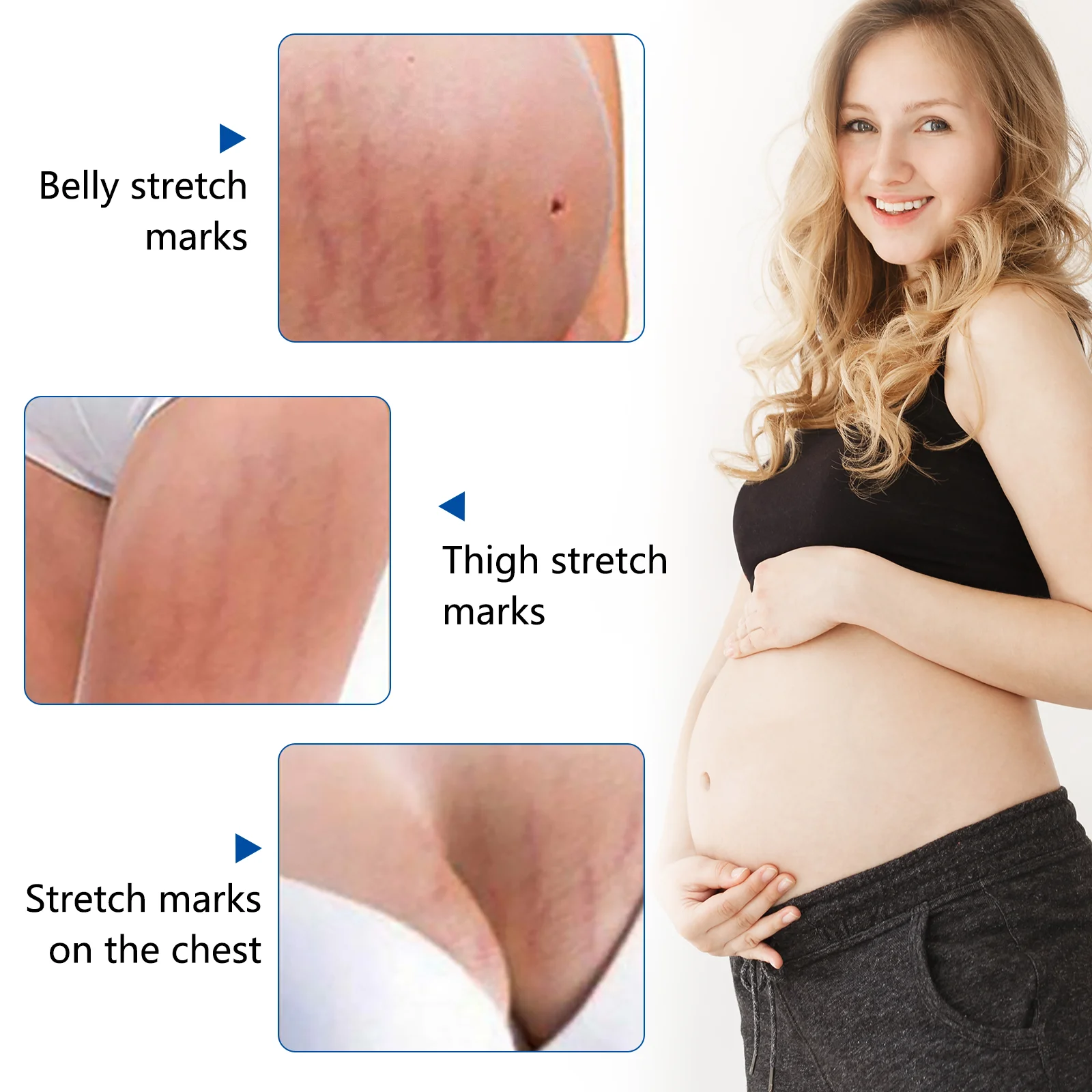 SEFUDUN body care 30 ml organic natural plant extract skin revitalizer anti-aging skin firming stretch marks essential oil