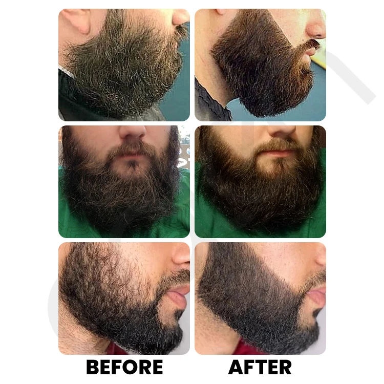 Luxfume Private Label Moisturizing Anti Itch Support Growth Beard Oil For Men