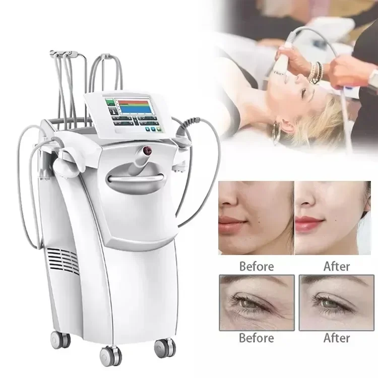 Venus Legacy Actimel PEMF Machine Radiofrequency Vacuum RF Sculpting Slimming Machine Cellulite Machine 4d Monopolar Multipolar