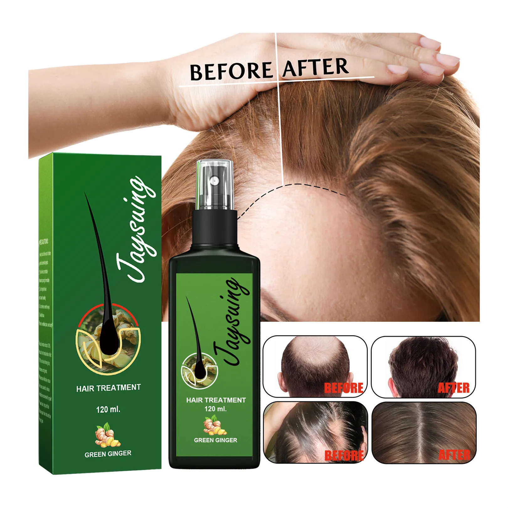 Ginger Liquid Spray for Women Men Regrowth Anti Hair Loss Oils for Hair Growth Hair growth intensive spray
