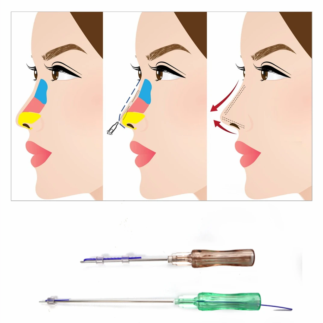 Korea Face Nose Lift Disposable 3D 4D 6D Cog Thread Pdo Thread