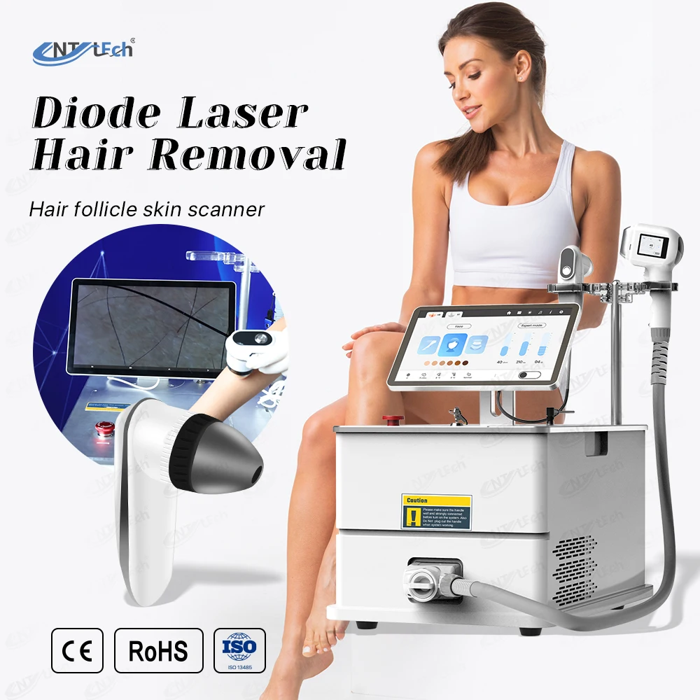 Professional smart patient database diode laser hair removal machine hair remove