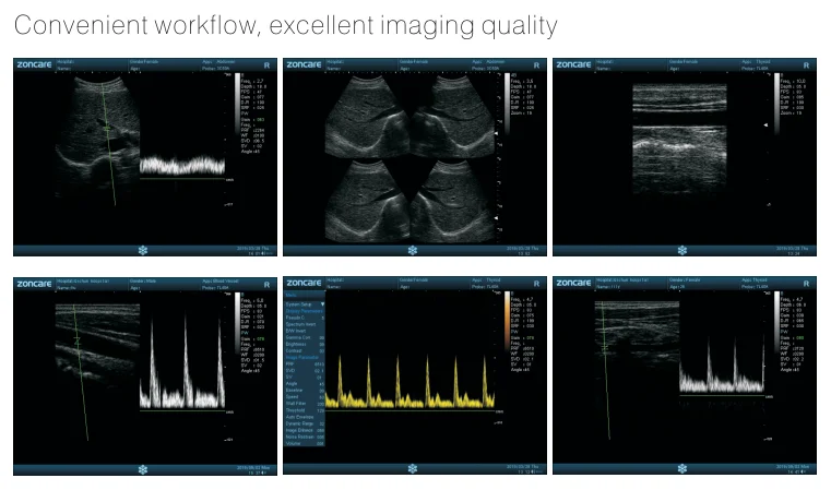 
Factory price wholesale Portable ultrasound machine black and white laptop doppler ultrasound machine 