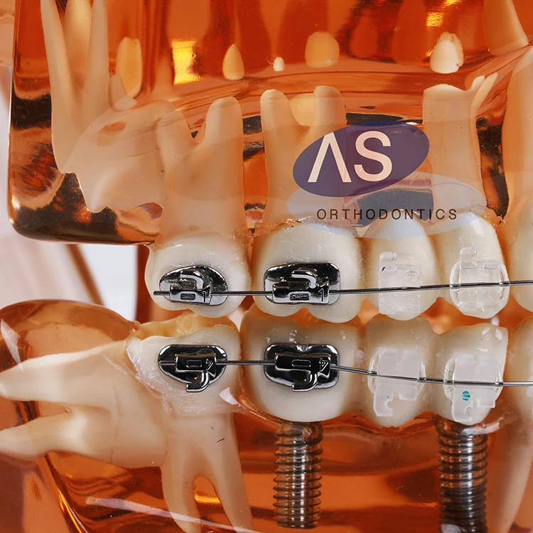 Orthodontics Material Ortho Buccal Tube with Molar