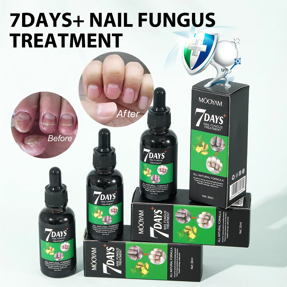 30ml MOOYAM 7 Days Fingernails Toenails Fungus Treatment Serum Repairs Damage and Treat Fungal Bacterial Infections Nail Serum