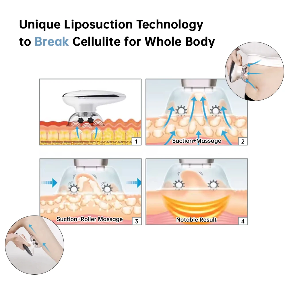 Силиконовый роликовый вакуумный массажер для ног