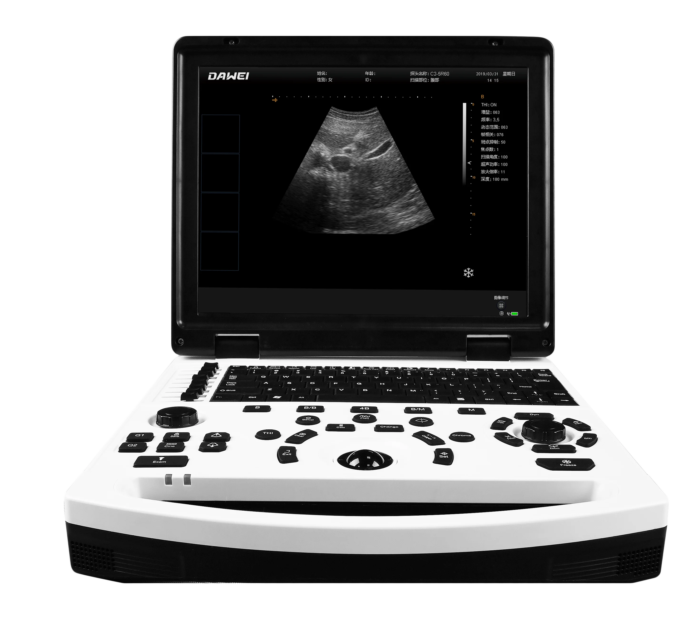 Dawei vet ultrasound machine 12.1 inch veterinary ultrasound scanner