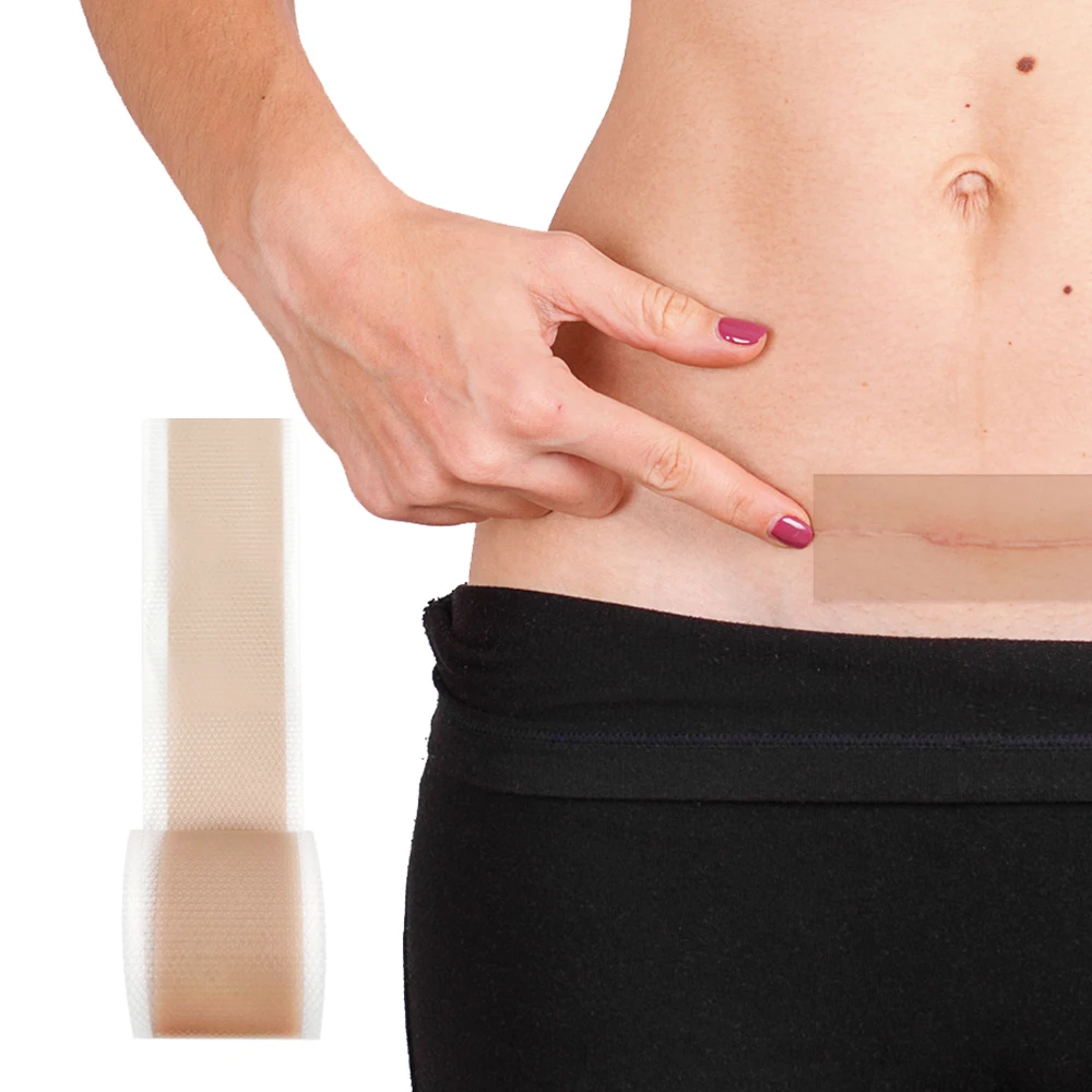 Scar sheets reusable scar tape for c-section keloid bump stretch marks burn tummy tuck surgical scar removal
