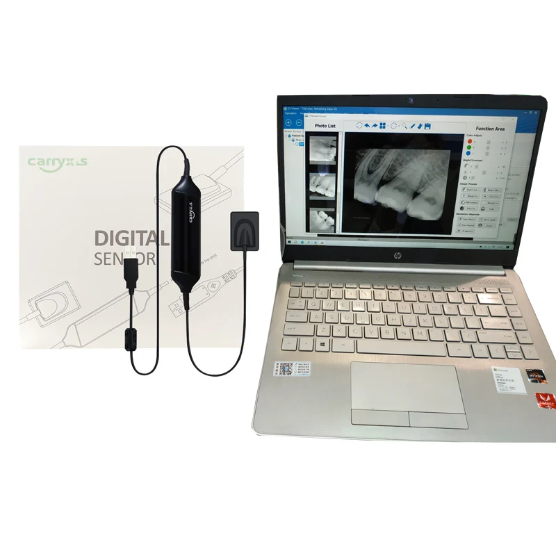 Factory Price Size1.3 Dental RVG Sensor For Dental X-Ray