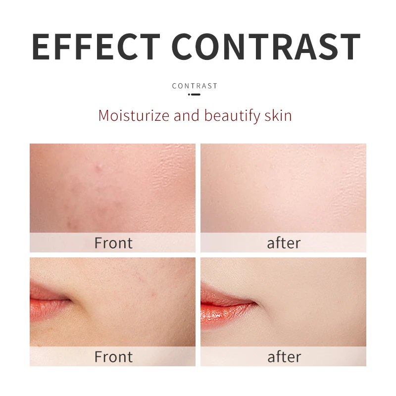 CAHSAI moisturizing deep hydrates protects skin firming dragon blood nicotinamide skin care serum for face