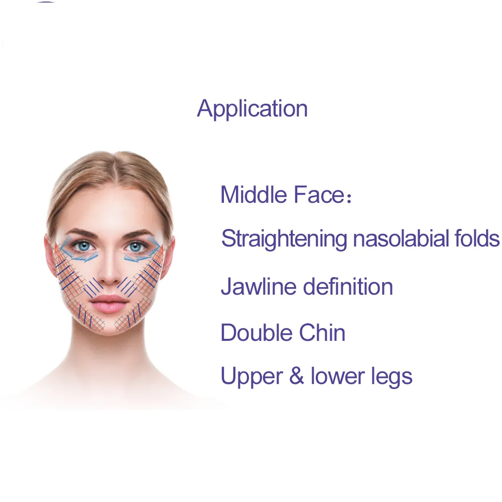  Красота в Сеуле hilos tenandroid cog 3d 4d резьба facelift pdo полидиоксанон для подтяжки носа